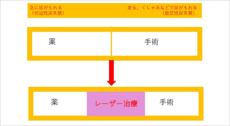 「尿トラブル」は、投薬治療以外では手術しか選択肢がなかったもの。