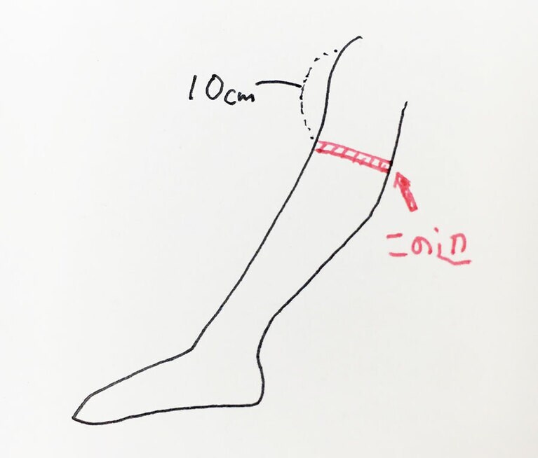 むくみ自己チェック。