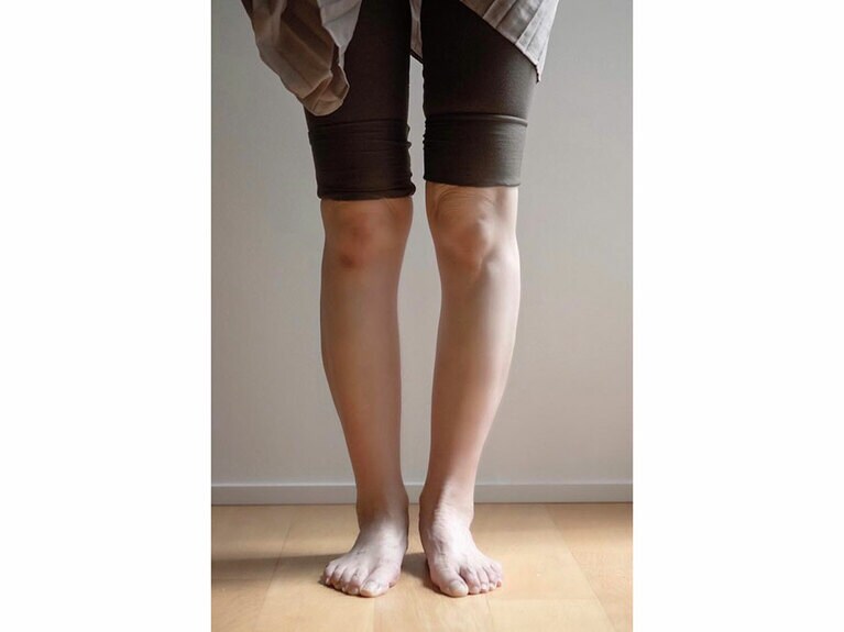 10分間ブラシを当てたアフター。向かって右の足のむくみが取れて、全体が上がっているのがわかります。