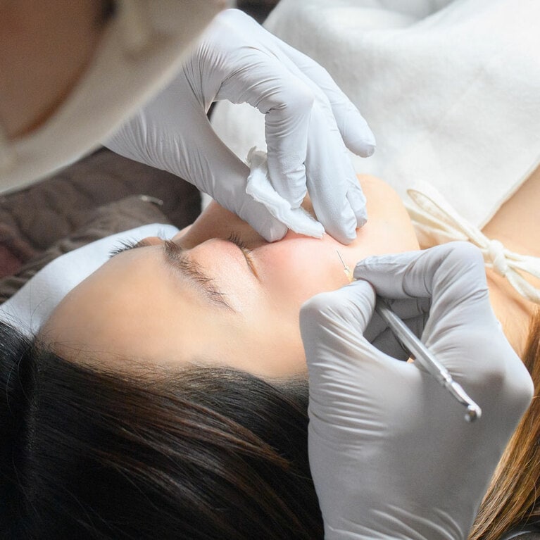 クリームによる局所麻酔を施すので、痛みの心配が少ない。傷の大きさによって金額は異なるが、5mmほどの部位でW50,000～。不安な場合は公式LINE（@rodamjp）を通じて相談することも可能。