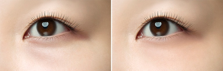 左がBeforeで右がAfter。ごく自然に見えるようにカバーされている。