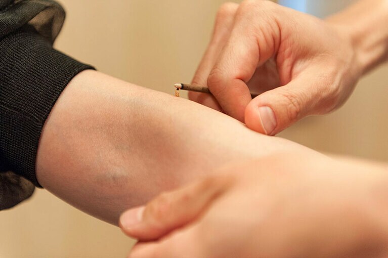 お灸のイメージが変わる！