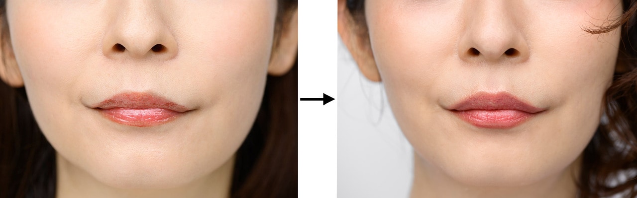 写真左から、BERORE画像、AFTER画像。