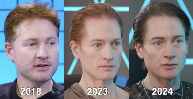 ブライアンのXで公開された、容姿の変化を比較した写真。公式Xより引用。